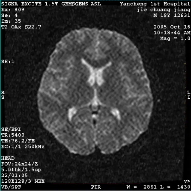 قطعة أثرية WI/Fiesta Image White Pixel